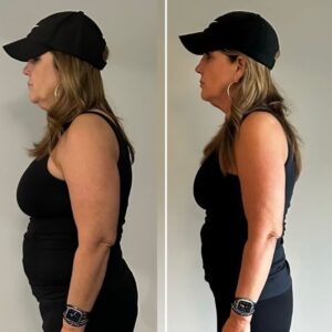 Side by side image of a woman on a weight loss journey. 