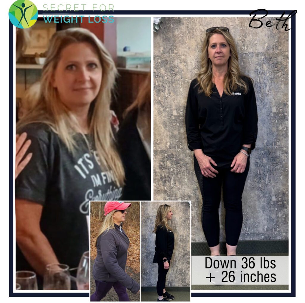 Beth Before After SWL